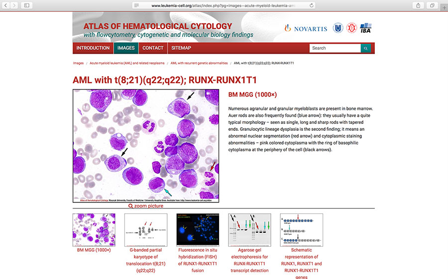 Atlas of Hematological Cytology – with flowcytometry, cytogenetic, and molecular biology findings