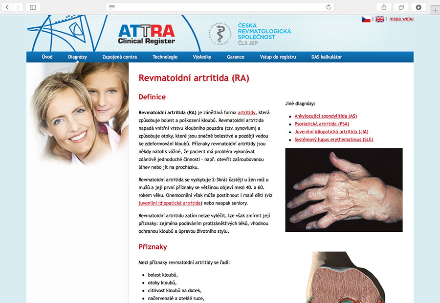 ATTRA: multicentrický systém pro hodnocení průběhu a výsledků biologické terapie ankylozující spondylitidy, juvenilní idiopatické artritidy, psoriatické artritidy, revmatoidní artritidy a SLE (systémový lupus erythematosus).
