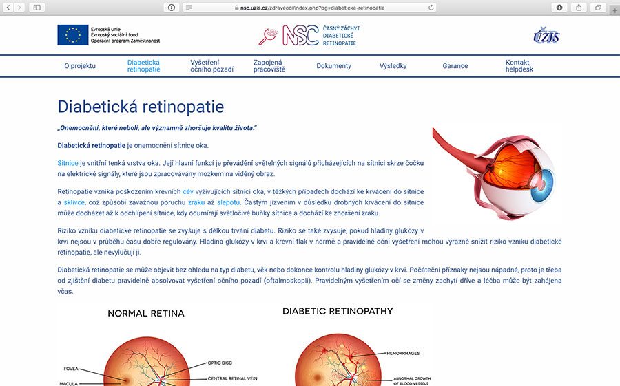 Časný záchyt diabetické retinopatie a makulárního edému u pacientů s diabetem 1. nebo 2. typu