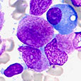 An online atlas of haematological cytology with flowcytometry, cytogenetic, and molecular biology findings.