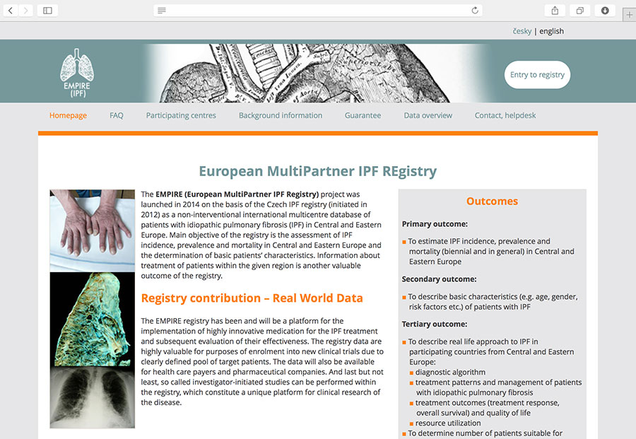EMPIRE: clinical registry of patients with idiopathic pulmonary fibrosis (IPF)